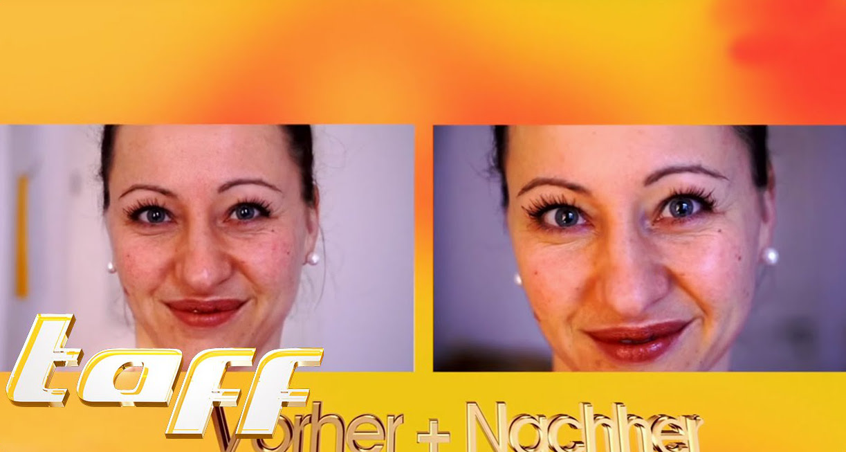 taff Episode: Tinas Gesichtsbehandlungen haben es in sich!